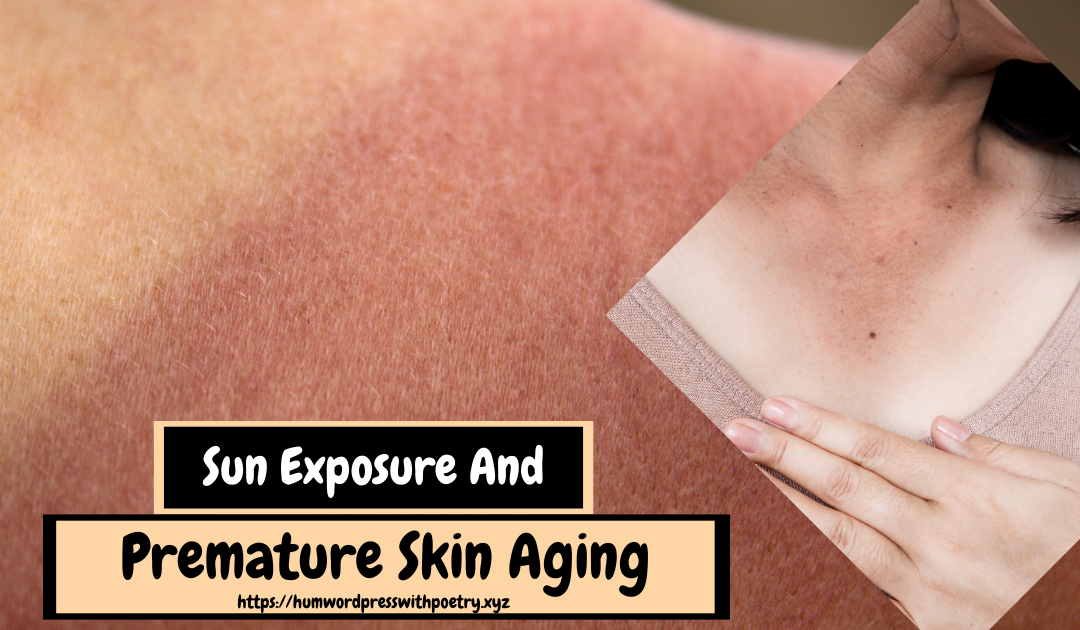 Sun Exposure And Premature Skin Aging