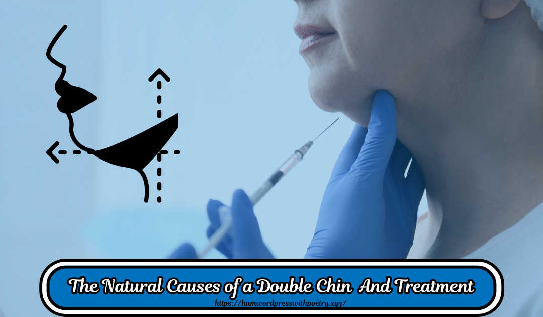 The Natural Causes of a Double Chin  And Treatment