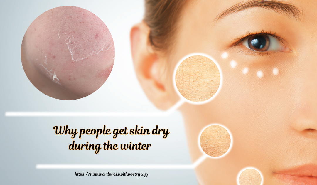 Why people get skin dry during the winter