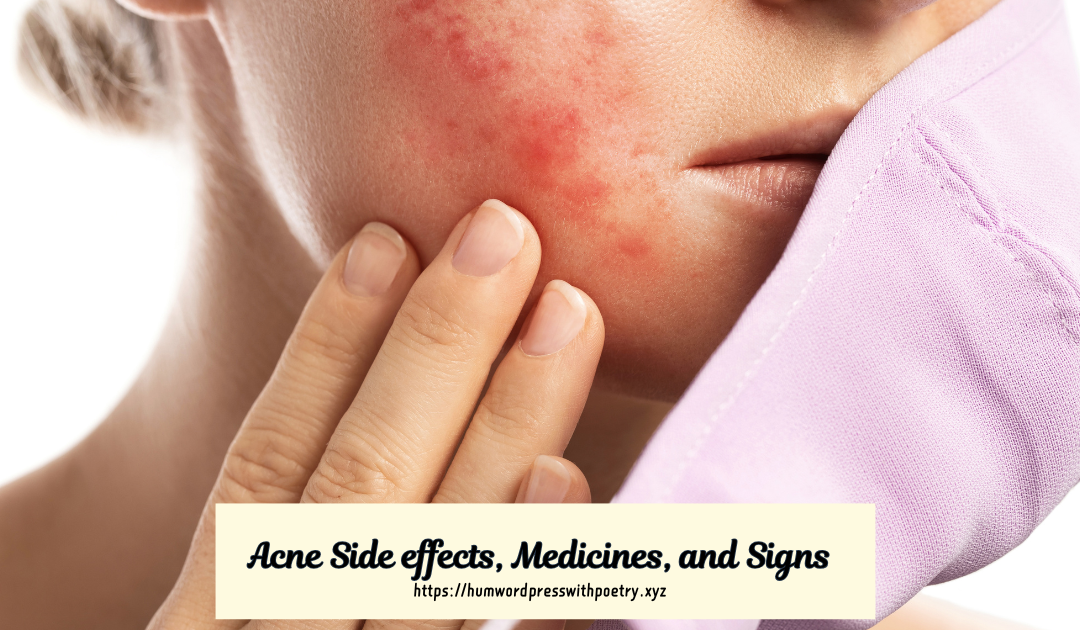 Acne Side effects Medicines and Signs